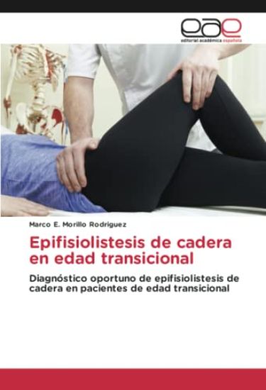 Epifisiolistesis de cadera en edad transicional