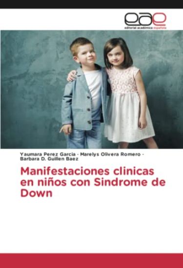 Manifestaciones clinicas en niños con Sindrome de Down