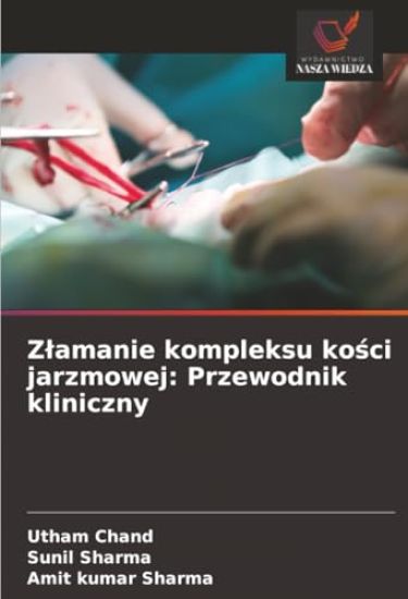 Zlamanie kompleksu kosci jarzmowej