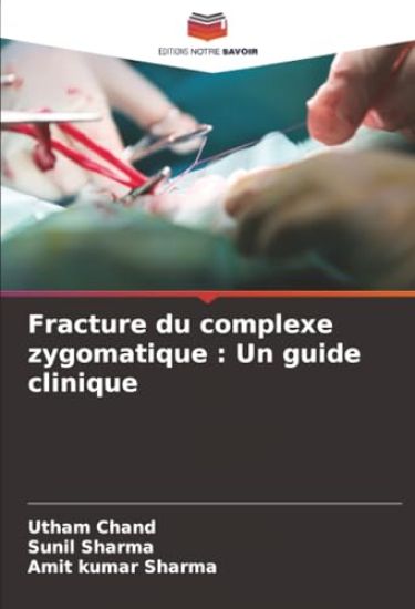 Fracture du complexe zygomatique