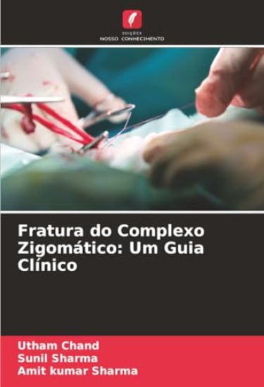 Fratura do Complexo Zigomático