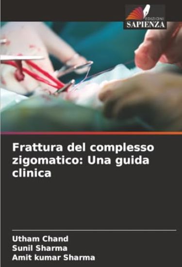 Frattura del complesso zigomatico