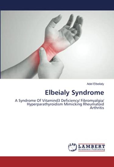 Elbeialy Syndrome