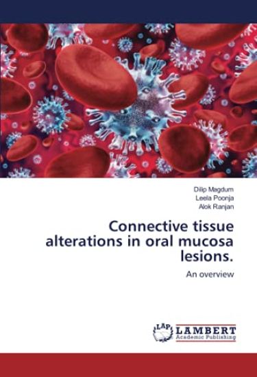 Connective tissue alterations in oral mucosa lesions.