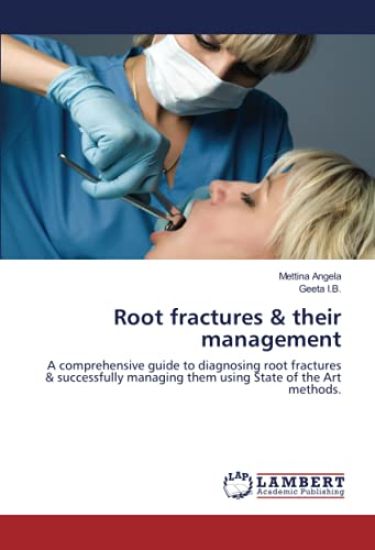 Root fractures & their management