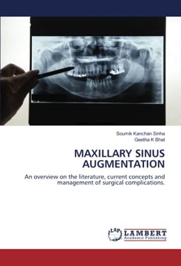 MAXILLARY SINUS AUGMENTATION