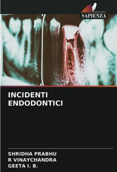 Incidenti Endodontici