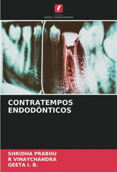 CONTRATEMPOS ENDODÔNTICOS