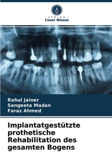 Implantatgestützte prothetische Rehabilitation des gesamten Bogens