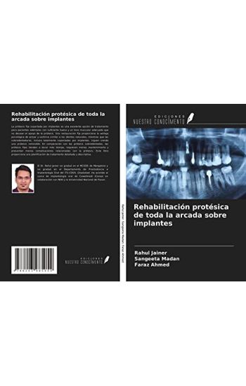 Rehabilitación protésica de toda la arcada sobre implantes