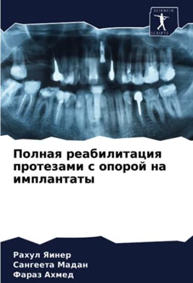 Polnaq reabilitaciq protezami s oporoj na implantaty