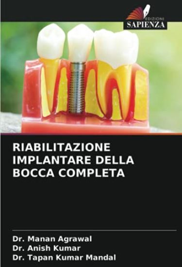 RIABILITAZIONE IMPLANTARE DELLA BOCCA COMPLETA