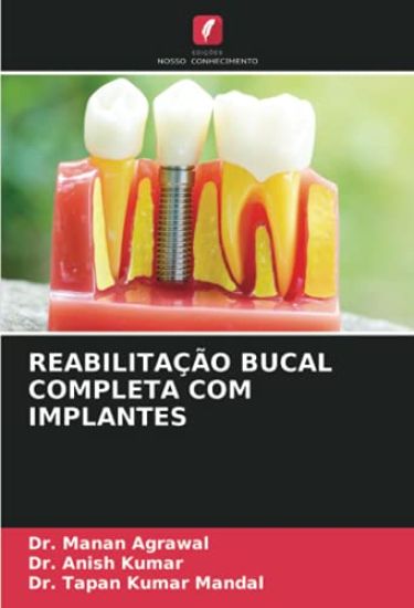 REABILITAÇÃO BUCAL COMPLETA COM IMPLANTES