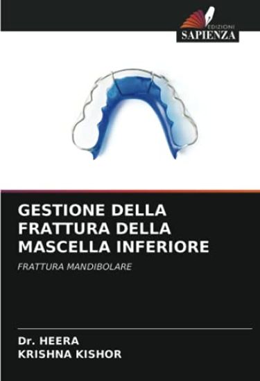 GESTIONE DELLA FRATTURA DELLA MASCELLA INFERIORE