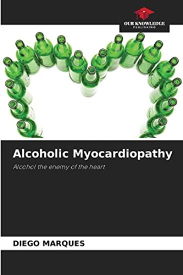 Alcoholic Myocardiopathy