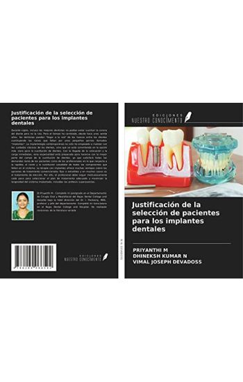 Justificación de la selección de pacientes para los implantes dentales