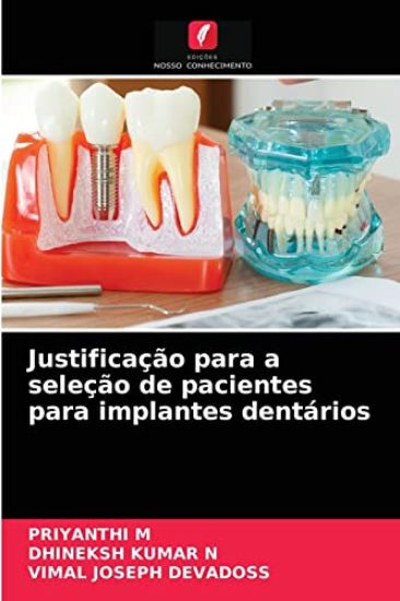 Justificação para a seleção de pacientes para implantes dentários