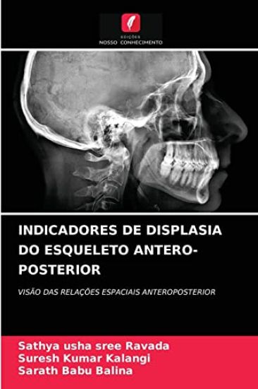 Indicadores de Displasia Do Esqueleto Antero-Posterior