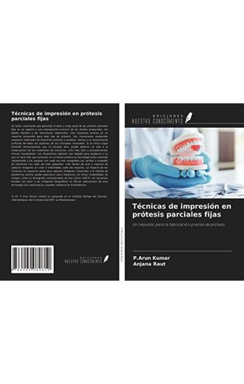 Técnicas de impresión en prótesis parciales fijas
