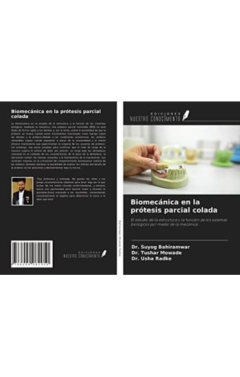 Biomecánica en la prótesis parcial colada