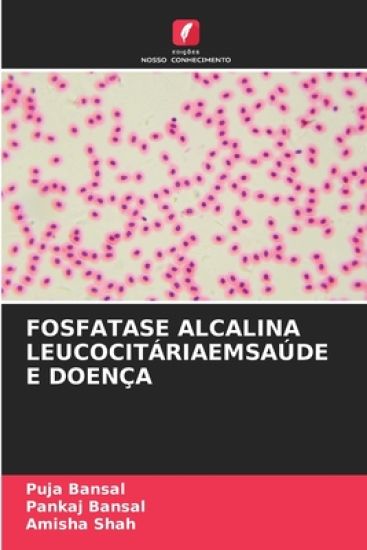 Fosfatase Alcalina Leucocitáriaemsaúde E Doença