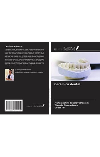 Cerámica dental