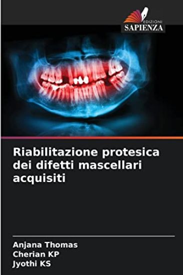 Riabilitazione protesica dei difetti mascellari acquisiti