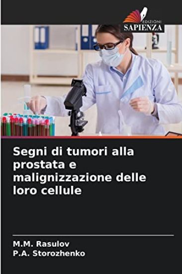 Segni di tumori alla prostata e malignizzazione delle loro cellule