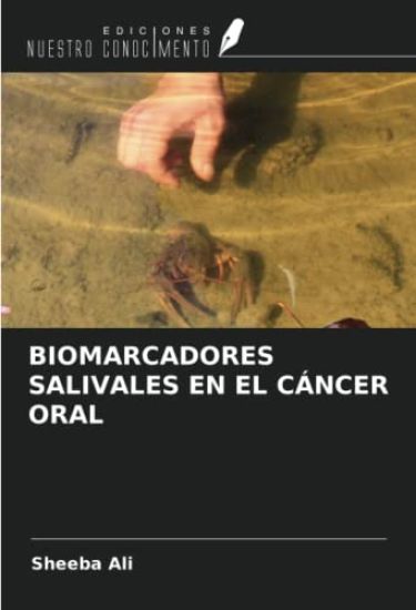 BIOMARCADORES SALIVALES EN EL CÁNCER ORAL