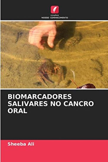 Biomarcadores Salivares No Cancro Oral