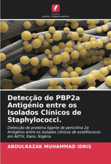 Detecção de PBP2a Antigénio entre os Isolados Clínicos de Staphylococci.