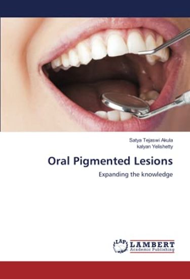 Oral Pigmented Lesions