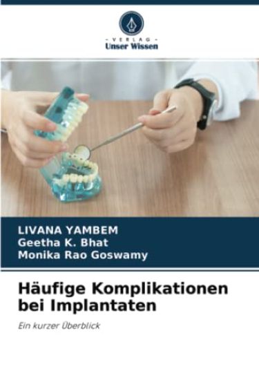 Häufige Komplikationen bei Implantaten