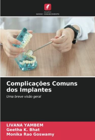 Complicações Comuns dos Implantes