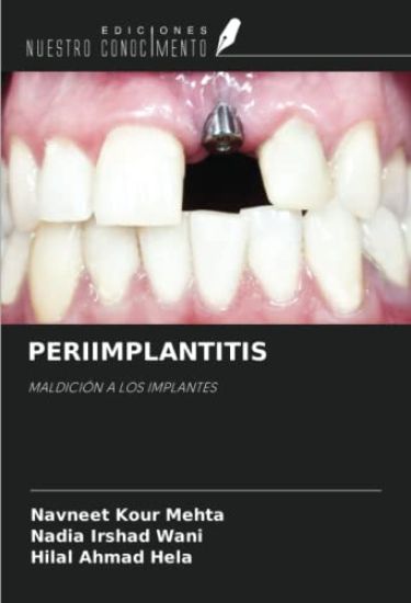 PERIIMPLANTITIS