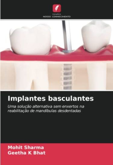 Implantes basculantes