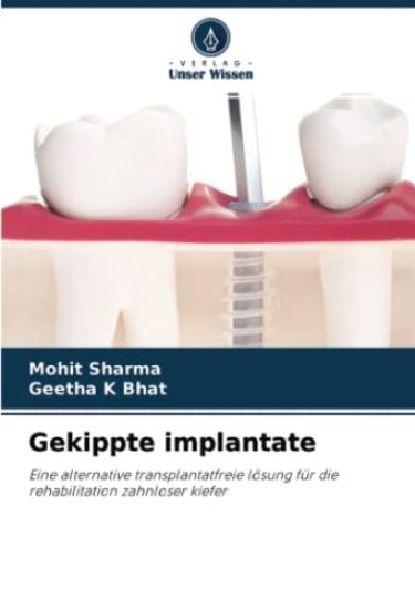 Gekippte implantate