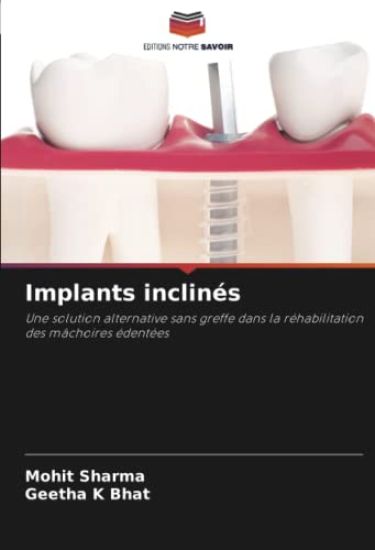 Implants inclinés