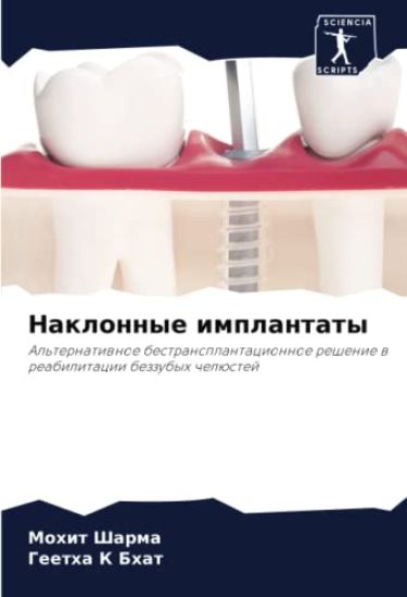 Naklonnye implantaty