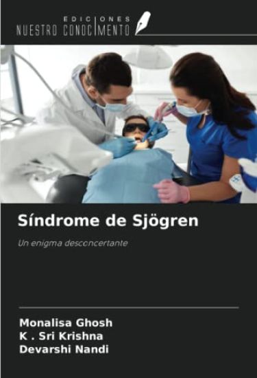 Síndrome de Sjögren