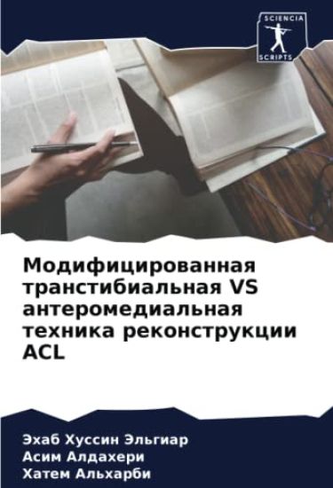 Modificirowannaq transtibial'naq VS anteromedial'naq tehnika rekonstrukcii ACL