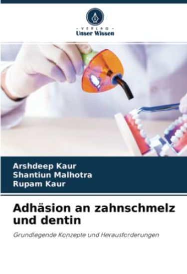 Adhäsion an zahnschmelz und dentin
