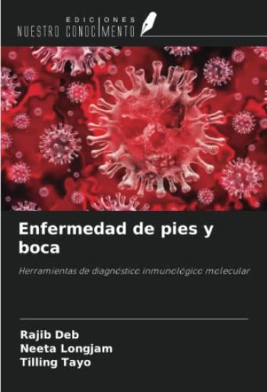 Enfermedad de pies y boca