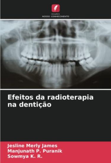 Efeitos da radioterapia na dentição