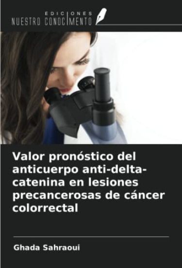 Valor pronóstico del anticuerpo anti-delta-catenina en lesiones precancerosas de cáncer colorrectal
