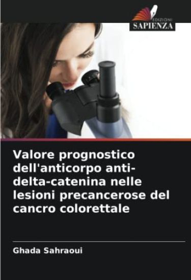 Valore prognostico dell'anticorpo anti-delta-catenina nelle lesioni precancerose del cancro colorettale