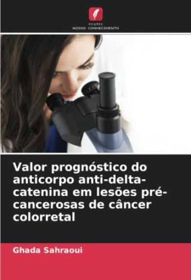 Valor prognóstico do anticorpo anti-delta-catenina em lesões pré-cancerosas de câncer colorretal