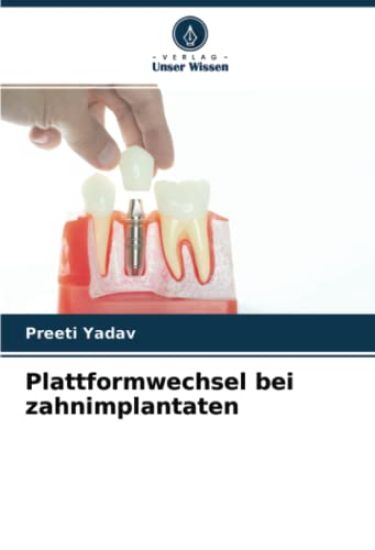 Plattformwechsel bei zahnimplantaten
