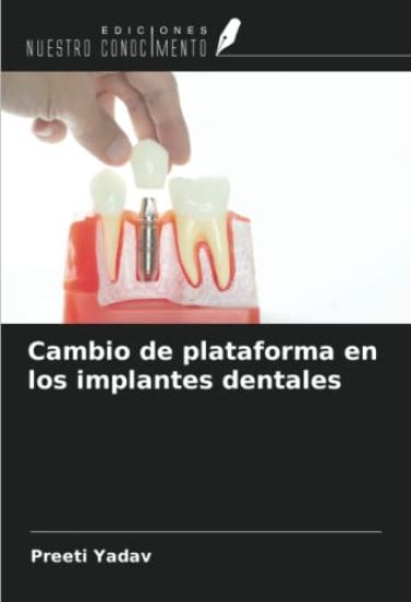 Cambio de plataforma en los implantes dentales