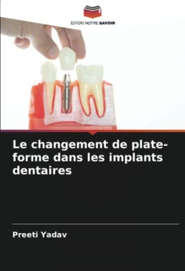 Le changement de plate-forme dans les implants dentaires